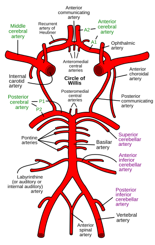 Circle of Willis