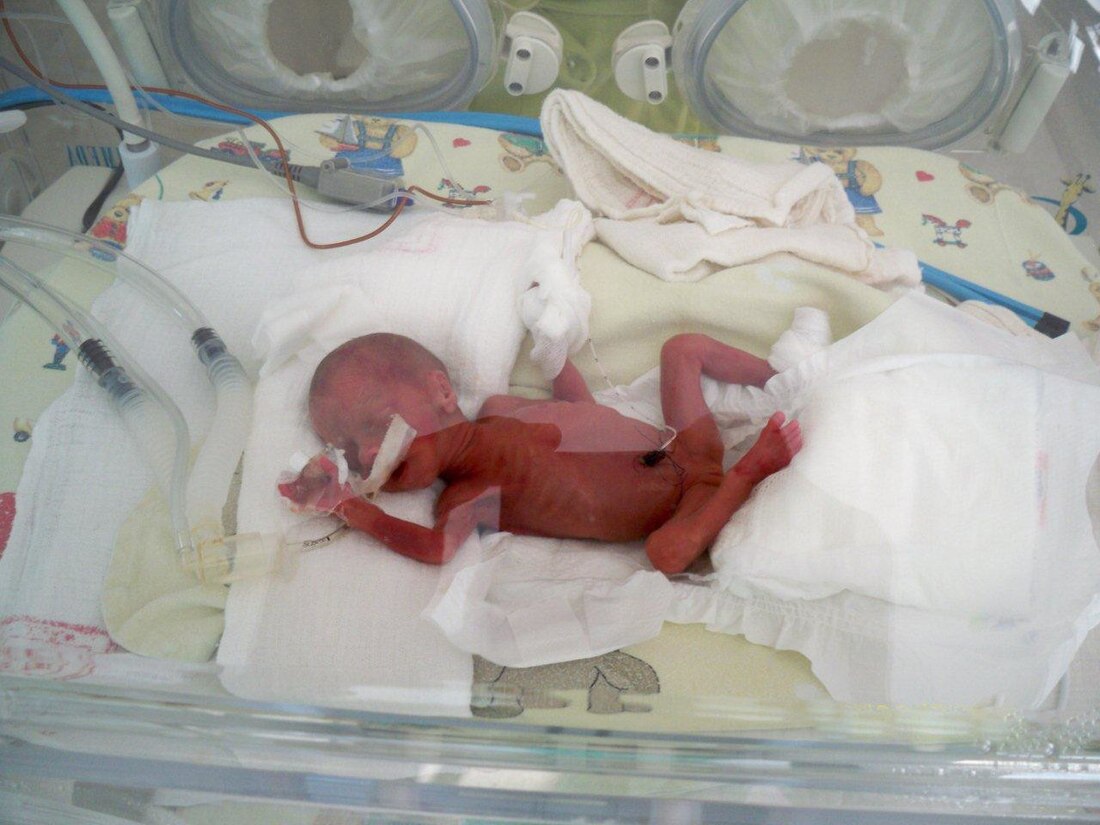 Low birth weight